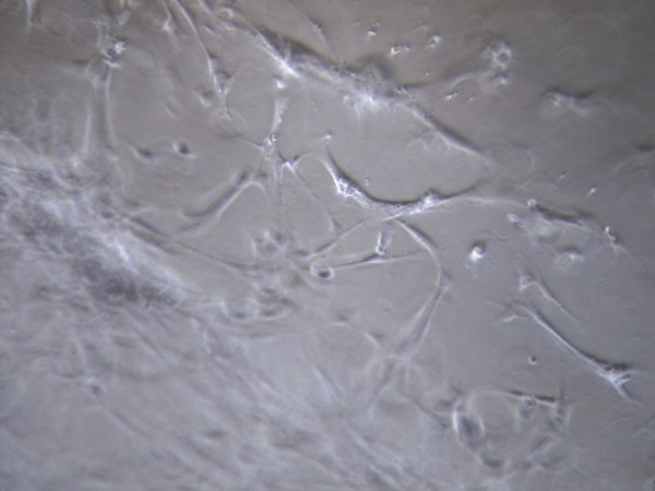 кератоциты на роговичной поверхности контактной линзы Biofinity.  Фазово-контрастная микроскопия ув. х200. Материал - human.