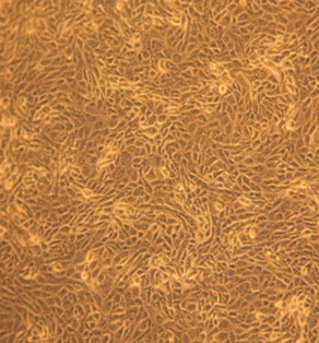 Культура клеток MDBK под микроскопом