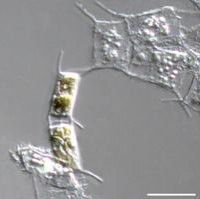 Клетки морской диатомовой водоросли Attheya ussurensis после замораживания в присутствии трегалозы 