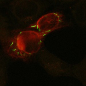 оверэкспрессия fam185a-GFP Keratin-RFP HELA cells